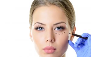 Beverly Hills Eyelid Surgery